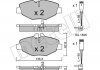 Колодки гальмівні (передні) MB E-class (W211/S211) 02-09 (+датчики) Metelli 22-0562-0K (фото 2)